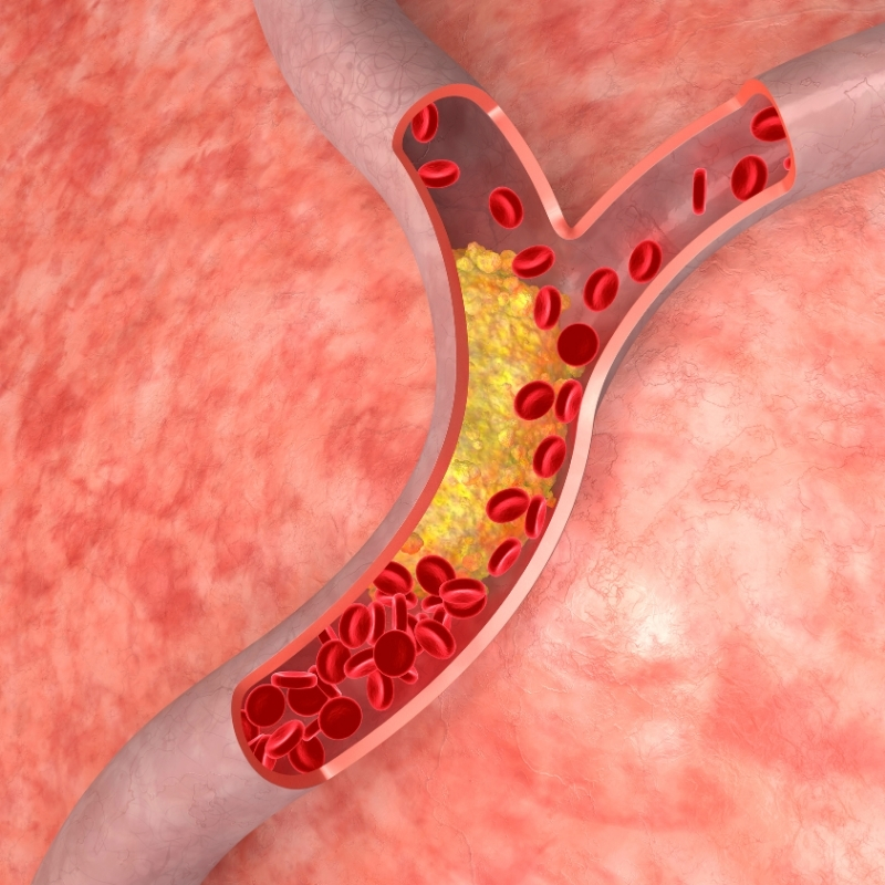 כולסטרול